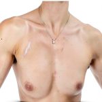 Organ Transplant Surgery Kindle eBook by Author – 98 Pages Enhanced-0