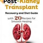Kindle Transplant Surgery Guide by Amazon-0