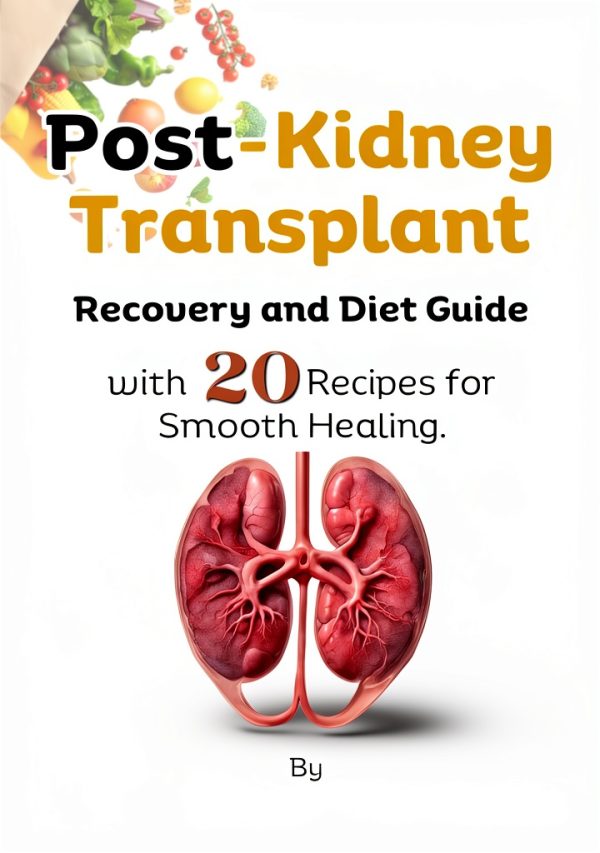 Kindle Transplant Surgery Guide by Amazon-0